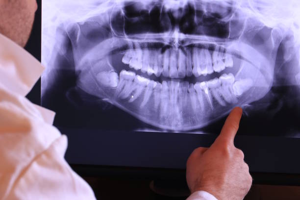 Best Emergency Dental Care for Broken or Chipped Teeth in Elizabethville, PA