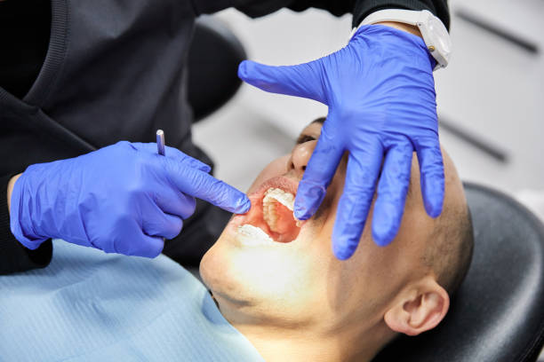 Best Emergency Dental Care for Broken or Chipped Teeth in Elizabethville, PA
