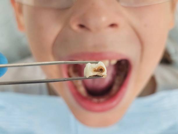 Best Emergency Denture Repair in Elizabethville, PA
