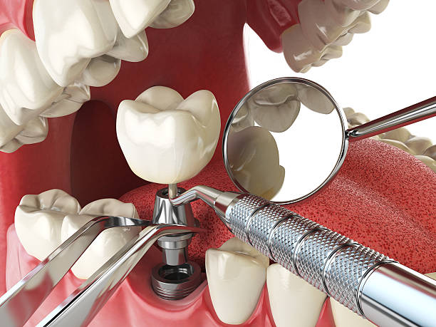 Best Emergency Treatment for Dental Infections or Abscesses in Elizabethville, PA
